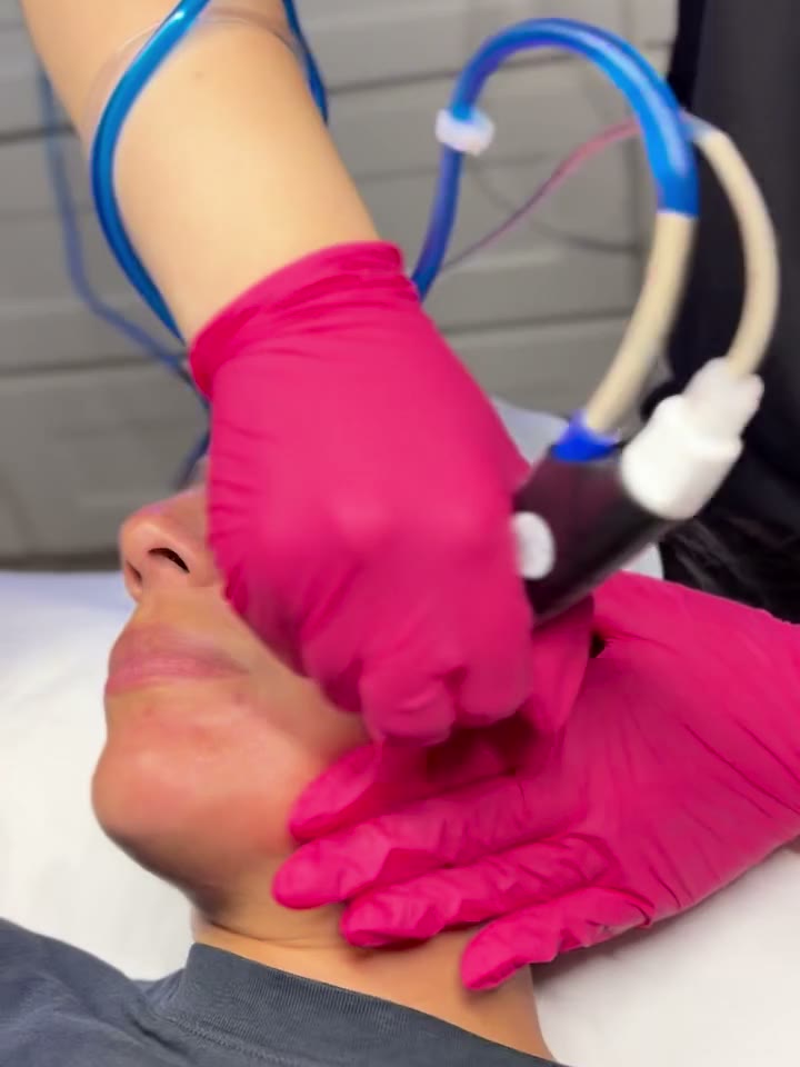 Gloved hands guiding a treatment handpiece along a patient's cheek